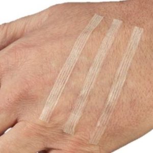 Skin Closure 3mm x 75mm Strip